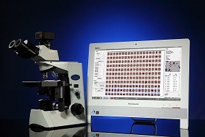 Ѹ��(sh��)MCN�t��(x��)��΢�����ܷ���ϵ�y(t��ng)