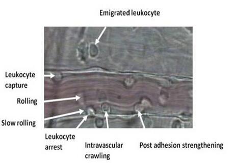 ΢Ѫ�ܷ���ϵ�y(t��ng)