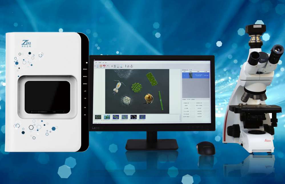 ����Ӌ(j��)��(sh��)���־�Ȧ�y(c��)��Ч�r(ji��)���@΢��(x��)�������x