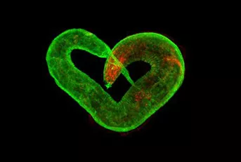 ���x�@΢ע����β�������Ԕ��(x��)��(sh��)�(y��n)���E����aס