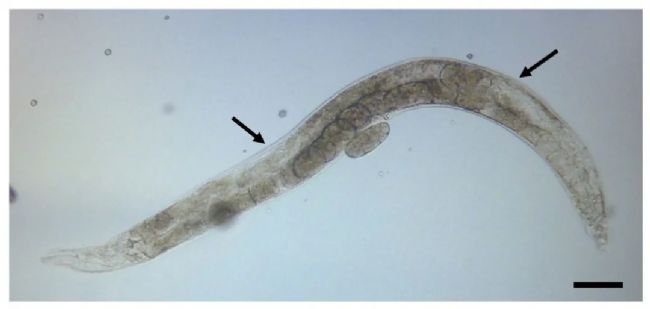 ���x�@΢ע����β�������Ԕ��(x��)��(sh��)�(y��n)���E����aס